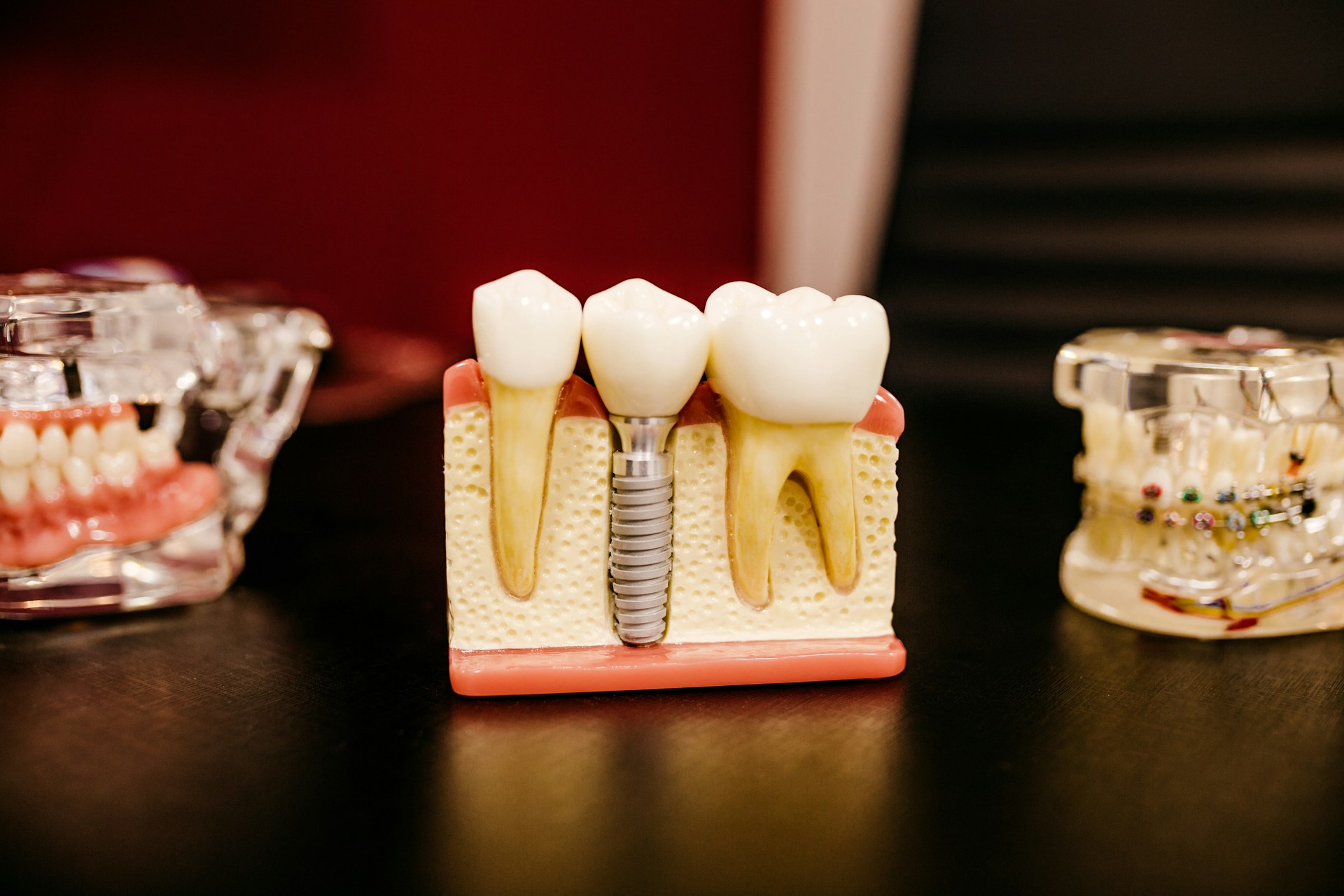 How Dental Implants Can Fix a Broken Smile